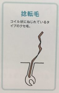 捻転毛
