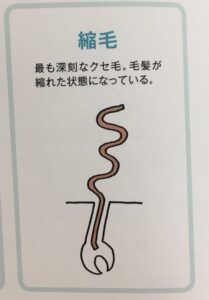 縮毛