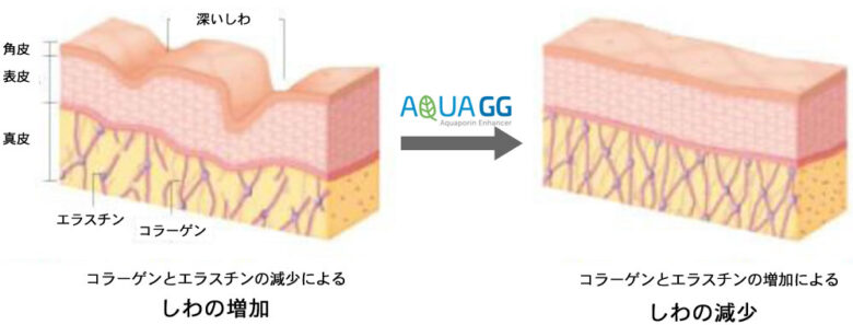 シワの増加とシワの減少