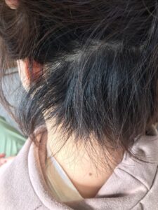 梳き過ぎ